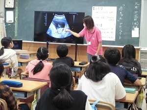 赤ちゃん